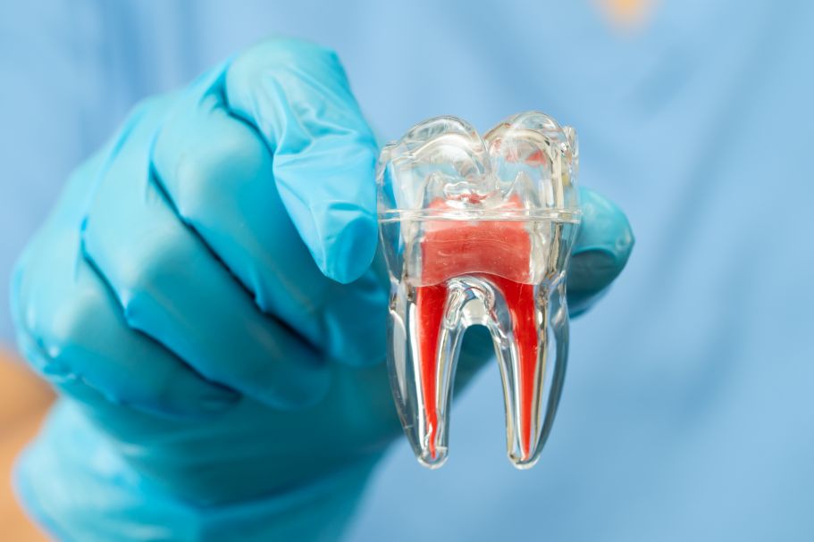 A hand holding a model of an infected tooth